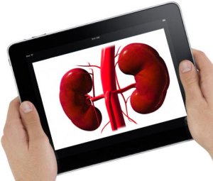 iPad-Kidney